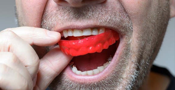 Man puts athletic mouthguard on teeth