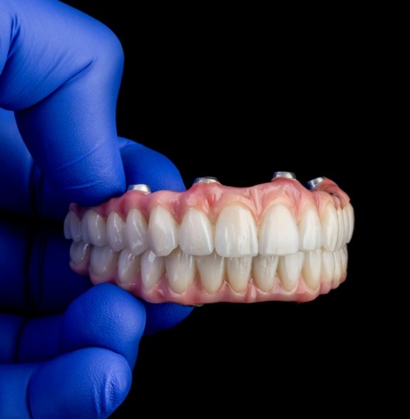 Gloved hand holding an implant denture