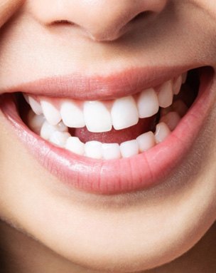 Close-up of woman’s smile with healthy gums