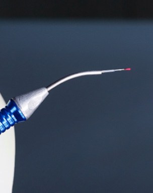 Close-up of dental laser with blue handle 