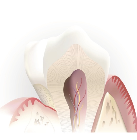 Illustration of tooth in receding gums