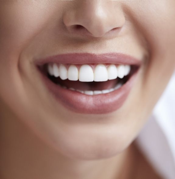 Close up of person smiling with flawless teeth and gums